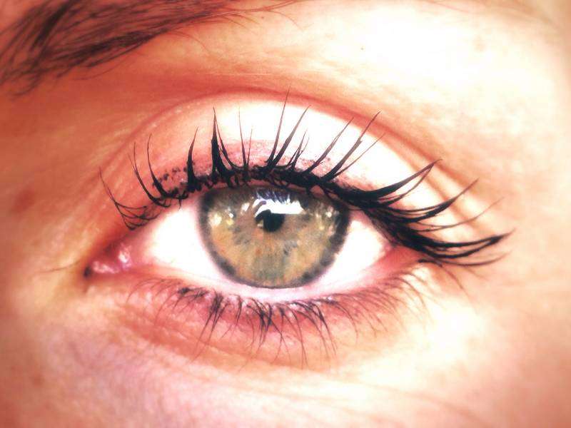 What Does Ectropion Eye Look Like?