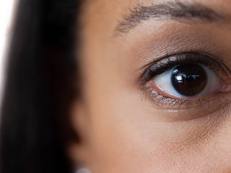 Can Drooping Eye Surgery Fix Ptosis?
