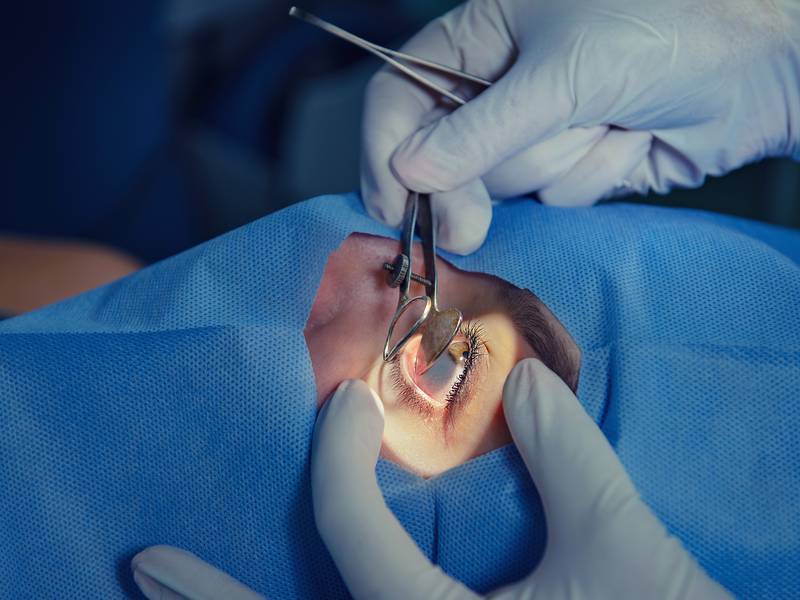 Who Performs Tear Duct Surgery?