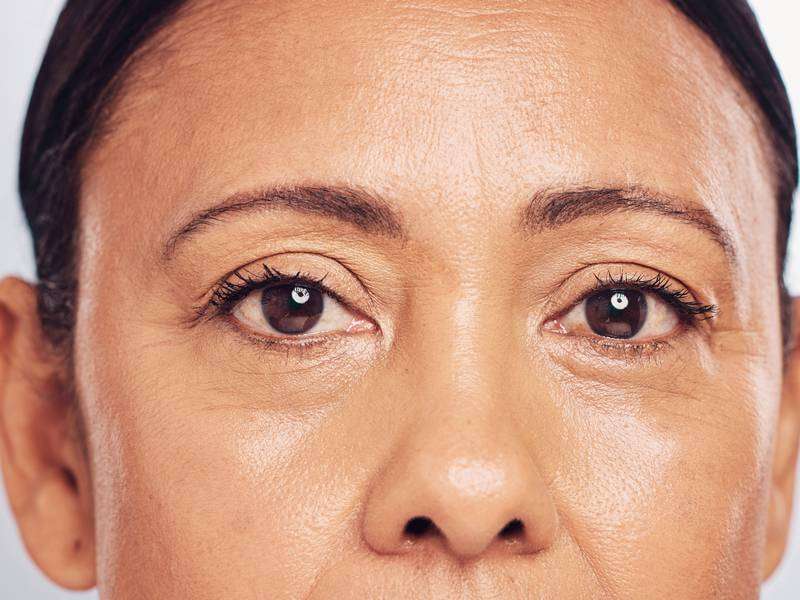 What Are Wrinkles Caused By?