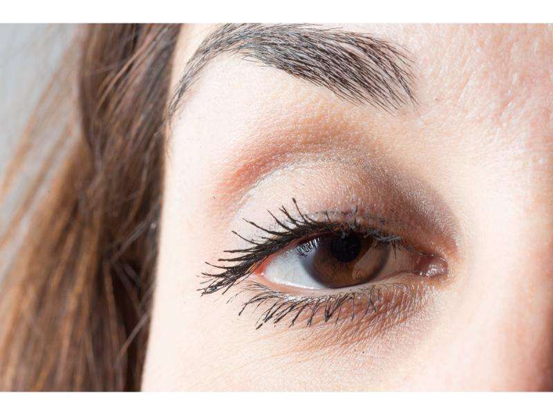 What Causes Droopy Upper Eyelids?