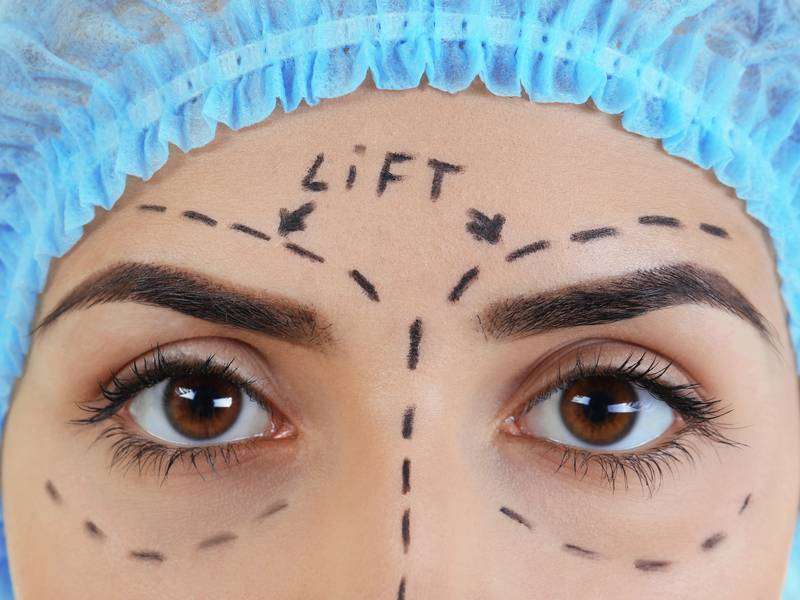 What is the Best Age to Get an Eyebrow Lift?