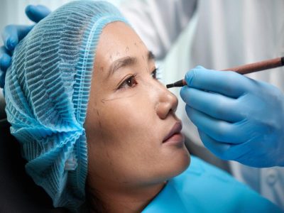 What Should I Know About Getting an Eyebrow Lift Near Troy, MI?