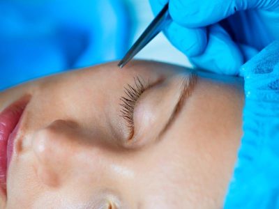 Should I Get Lower Eyelid Blepharoplasty in Flint, MI?