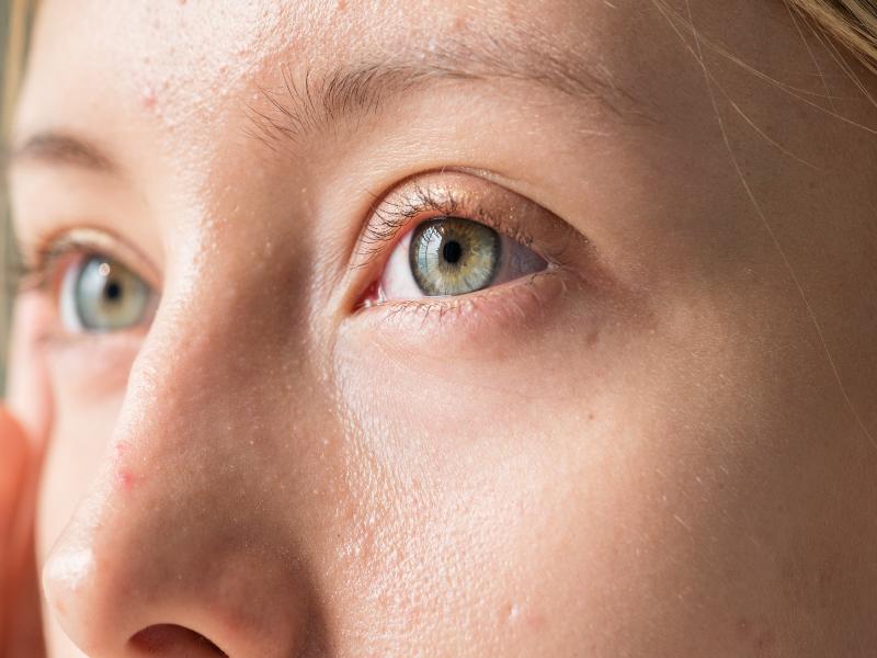 What Can You Expect from Your Tear Duct Surgery in Ann Arbor, MI?