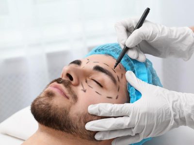 What is an Endoscopic Forehead Lift?