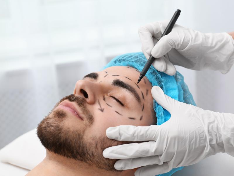 What is an Endoscopic Forehead Lift?