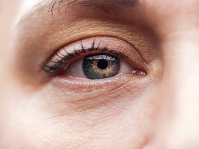 How To Recognize The Symptoms of Top Eyelid Drooping
