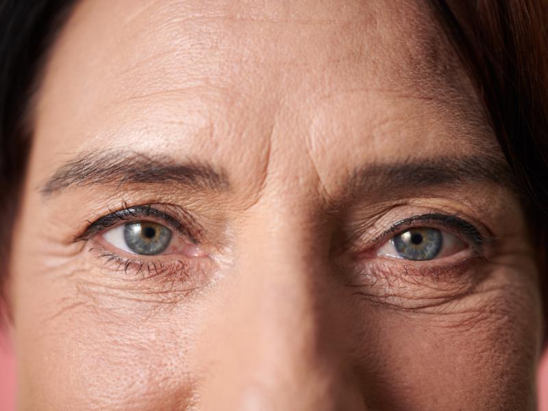 Should I Expect Scarring After Eye Bag Surgery?