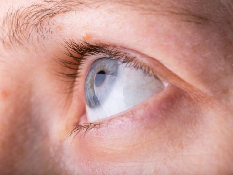 What Happens If Blocked Tear Ducts are Left Untreated?