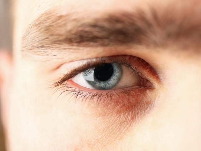 Living With Blocked Tear Ducts? Here’s What to Know