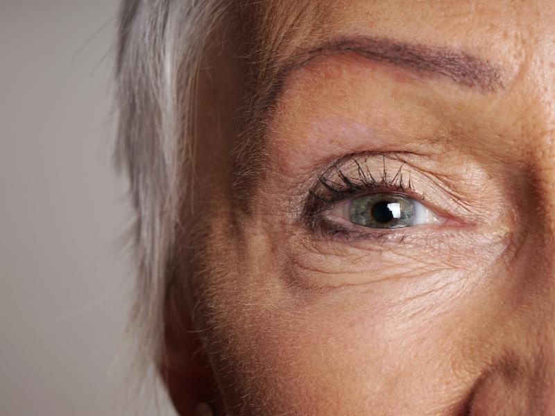 Is a Brow Lift the Missing Piece of Your Facial Rejuvenation Goals?