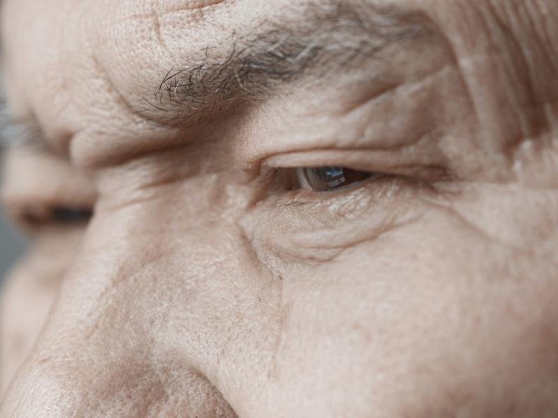 A Forehead Lift Should Be Planned Around Your Entire Upper Face