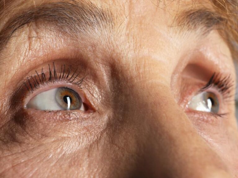 Tear Duct Surgery Starts With Understanding Where Tears Drain