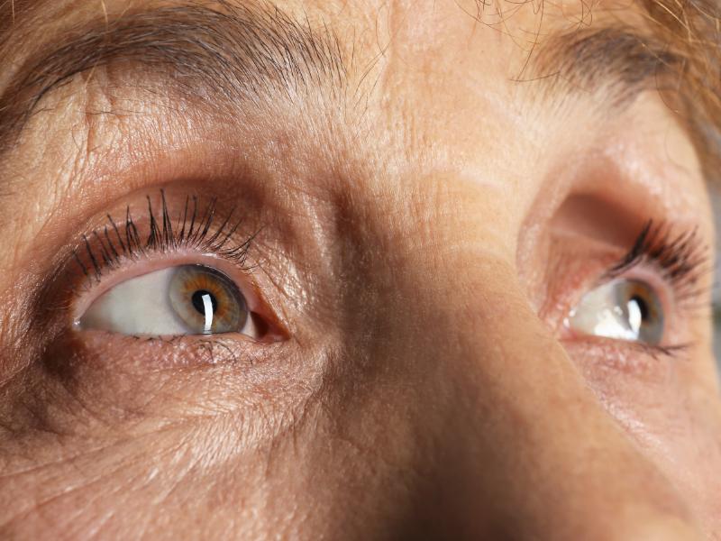 Tear Duct Surgery Starts With Understanding Where Tears Drain