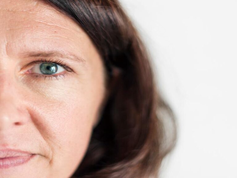 Refresh Your Appearance With a Brow Lift in St. Clair Shores, MI