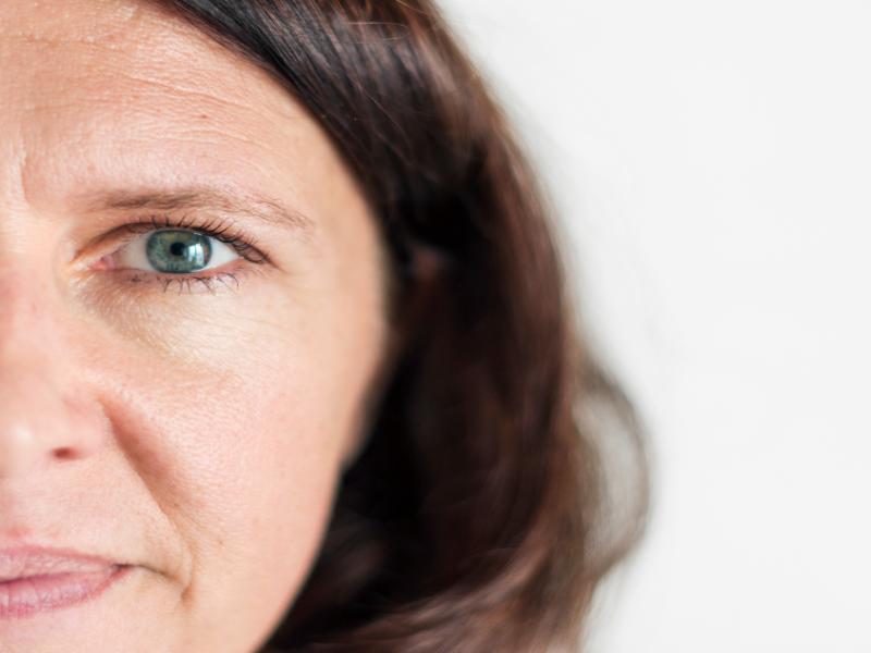 Refresh Your Appearance With a Brow Lift in St. Clair Shores, MI