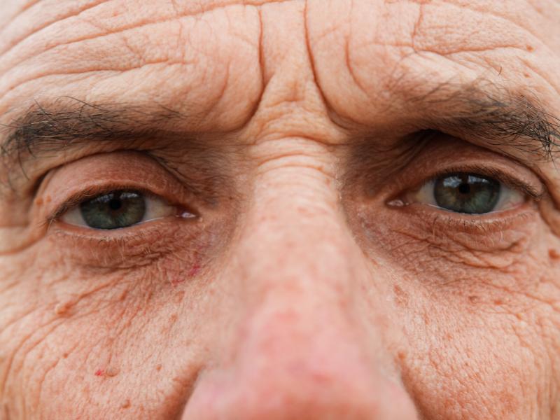 Treat Persistent Watery Eyes From Blocked Tear Ducts with Eyelid Pros in Southfield, MI