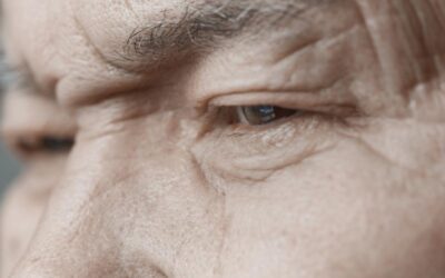 A Forehead Lift Should Be Planned Around Your Entire Upper Face