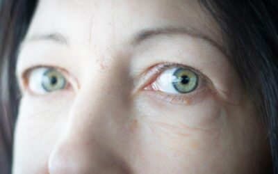Are Bulging Eyes Thyroid Related to Thyroid Disease?