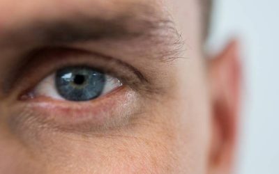 What Causes a Droopy Upper Eyelid?