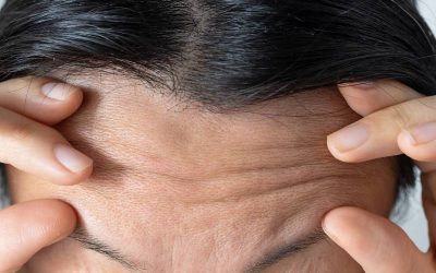 How Can I Get Rid of Wrinkles on My Forehead?