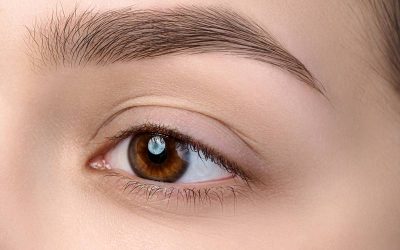 What is the Recovery Time For Lower Eyelid Blepharoplasty?