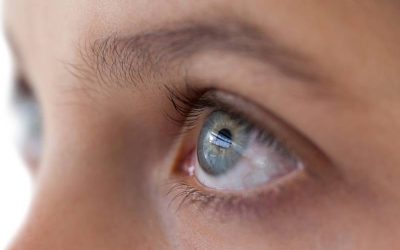 What Should I Do If My Top Eyelid is Drooping?