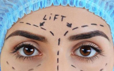 What is the Best Age to Get an Eyebrow Lift?