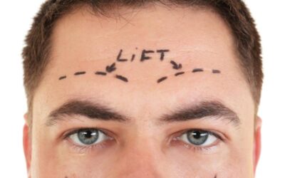 How to Prepare for an Eyebrow Lift Procedure
