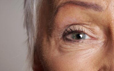 Is a Brow Lift the Missing Piece of Your Facial Rejuvenation Goals?