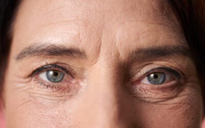 Should I Expect Scarring After Eye Bag Surgery?