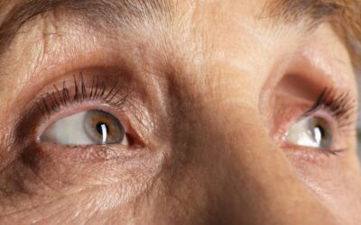 Tear Duct Surgery Starts With Understanding Where Tears Drain