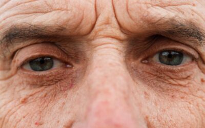 Treat Persistent Watery Eyes From Blocked Tear Ducts with Eyelid Pros in Southfield, MI