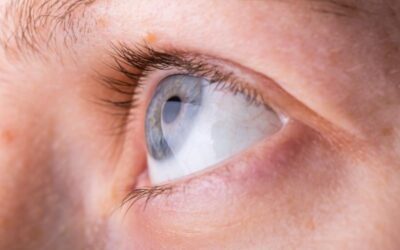 What Happens If Blocked Tear Ducts are Left Untreated?