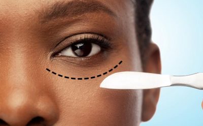 What Should I Expect for My Eye Bag Surgery Recovery Timeline?