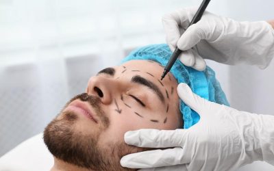 What is an Endoscopic Forehead Lift?