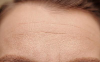 Wrinkles on Forehead? When a Brow Lift is the Right Solution